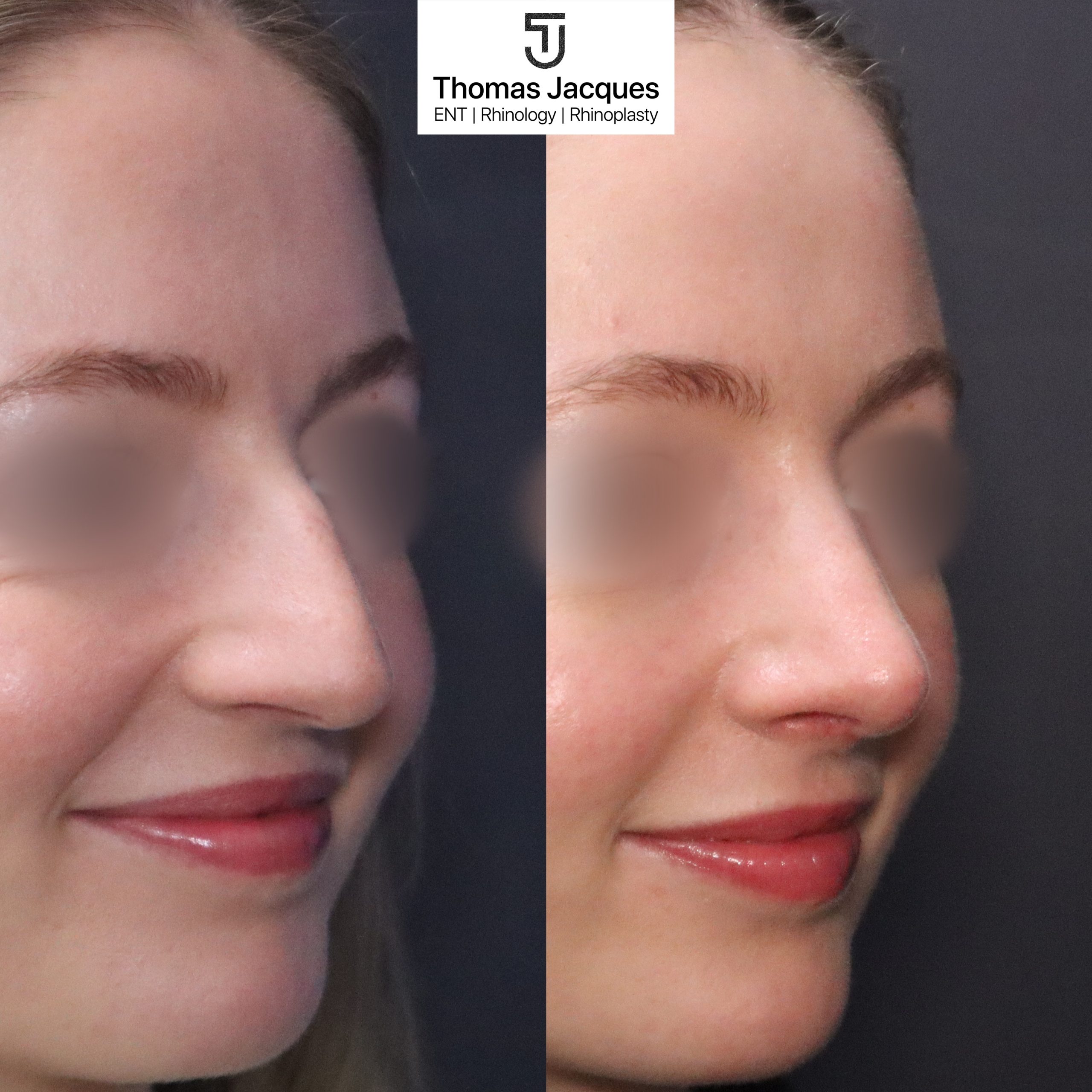 3/4 Profile